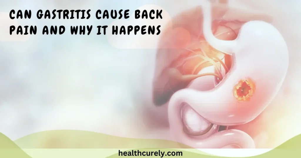 Can Gastritis Cause Back Pain and Why It Happens