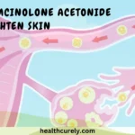 Does Progesterone Cause Weight Gain