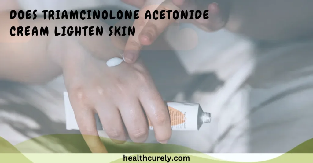 Does Triamcinolone Acetonide Cream Lighten Skin And Why It Happens