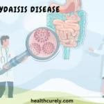 How Can Zydaisis Disease Be Cured The Truth First