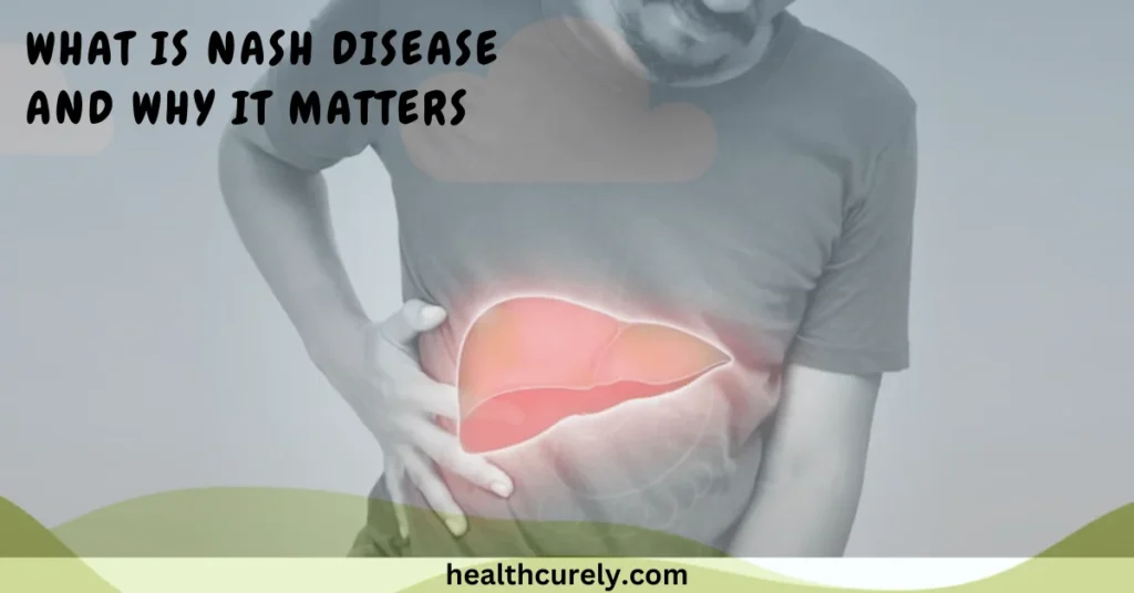 What Is NASH Disease and Why It Matters